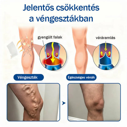 🍎🍎Medistart® Visszérápoló Mikrotűs Gondozó Tapasz ⚡ Azonnali Megkönnyebbülés, Hosszú Távú Eredmények