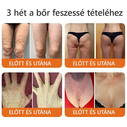 🍃 Bőrgyógyász ajánlása ✨ ZödVita® Méhméreg Bőr Helyreállító Krém 🔥 Magyar fejlesztés, magyarországi gyártás és szállítás