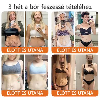 🍎Bőrgyógyász ajánlása ✨ ZödVita® Méhméreg Bőr Helyreállító Krém 🔥 Magyar fejlesztés, magyarországi gyártás és szállítás