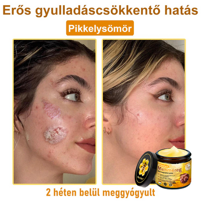 👨‍⚕‍🐝 𝐏𝐮𝐫𝐚𝐂𝐮𝐫𝐞® 𝐌é𝐡𝐦é𝐫𝐞𝐠 𝐁ő𝐫 𝐇𝐞𝐥𝐲𝐫𝐞á𝐥𝐥í𝐭ó 𝐊𝐫é𝐦 (𝐂𝐄 𝐓𝐚𝐧ú𝐬í𝐭𝐯á𝐧𝐲)👍✅