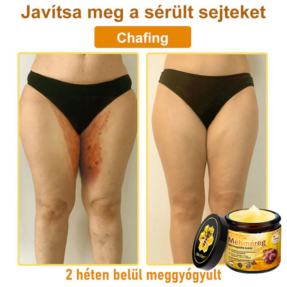 👨‍⚕‍🐝 𝐏𝐮𝐫𝐚𝐂𝐮𝐫𝐞® 𝐌é𝐡𝐦é𝐫𝐞𝐠 𝐁ő𝐫 𝐇𝐞𝐥𝐲𝐫𝐞á𝐥𝐥í𝐭ó 𝐊𝐫é𝐦 (𝐂𝐄 𝐓𝐚𝐧ú𝐬í𝐭𝐯á𝐧𝐲)👍✅