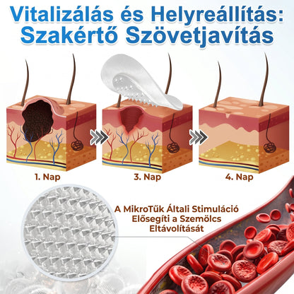 🌿🌿✨ 2 az 1-ben mikrotűs és hidrokolloid tapasz🍀 | Kiálló anyajegyek, aknék, lapos szemölcsök és bőrnövedékek eltávolítására | Segít csökkenteni a ráncokat, hegeket és bőrhibákat | Láthatatlan tapasz az arcra és testre