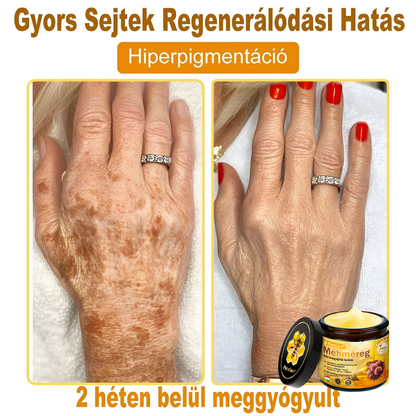 👨‍⚕‍🐝 𝐏𝐮𝐫𝐚𝐂𝐮𝐫𝐞® 𝐌é𝐡𝐦é𝐫𝐞𝐠 𝐁ő𝐫 𝐇𝐞𝐥𝐲𝐫𝐞á𝐥𝐥í𝐭ó 𝐊𝐫é𝐦 (𝐂𝐄 𝐓𝐚𝐧ú𝐬í𝐭𝐯á𝐧𝐲)👍✅