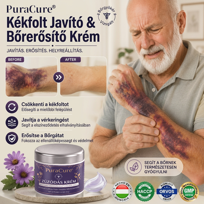 🍃🍃👉100K+ ELADVA 💁‍♀️ – PuraCure® Zúzódásjavító és bőrerősítő krém