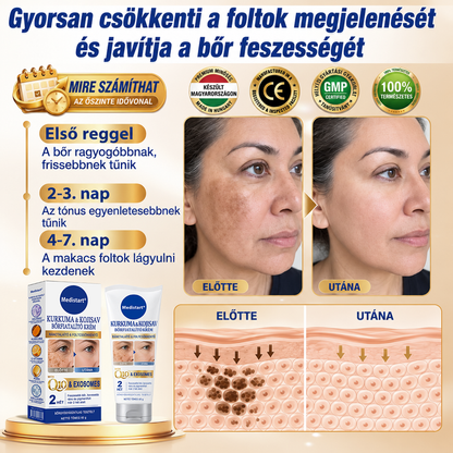 ❄️𝑯𝒊𝒗𝒂𝒕𝒂𝒍𝒐𝒔 𝑼̈𝒛𝒍𝒆𝒕 | 𝐔́𝐣! ✨ Medistart® 𝐊𝐮𝐫𝐤𝐮𝐦𝐚 × 𝐊𝐨𝐣𝐢𝐧𝐬𝐚𝐯 𝐄́𝐣𝐬𝐳𝐚𝐤𝐚𝐢 Bőrfiatalító 𝐊𝐫𝐞́𝐦— 𝐇𝐚𝐥𝐯𝐚́𝐧𝐲𝐢́𝐭𝐬𝐝 𝐚 𝐦𝐚𝐤𝐚𝐜𝐬 𝐬𝐨̈𝐭𝐞́𝐭 𝐟𝐨𝐥𝐭𝐨𝐤𝐚𝐭 𝐞́𝐬 𝐬𝐢𝐦𝐢́𝐭𝐬𝐝 𝐤𝐢 𝐚 𝐥𝐚́𝐭𝐡𝐚𝐭𝐨́ 𝐫𝐚́𝐧𝐜𝐨𝐤𝐚𝐭 𝐚𝐥𝐯𝐚́𝐬 𝐤𝐨̈𝐳𝐛𝐞𝐧 🌙 ✅ 𝐄́𝐣𝐬𝐳𝐚𝐤𝐚́𝐧𝐤𝐞́𝐧𝐭 𝐞𝐠𝐲 𝐥𝐞́𝐩𝐞́𝐬 · 𝐋𝐚́𝐭𝐡𝐚𝐭𝐨́ 𝐯𝐚́𝐥𝐭𝐨𝐳𝐚́𝐬 𝟕 𝐞́𝐣𝐬𝐳𝐚𝐤𝐚 𝐚𝐥𝐚𝐭𝐭 💯