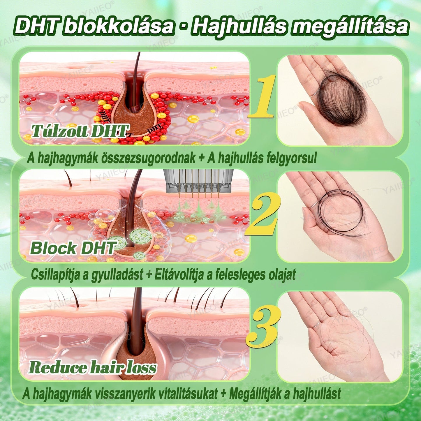 🍌𝐘𝐀𝐈𝐈𝐄𝐎® 𝑭á𝒋𝒅𝒂𝒍𝒐𝒎𝒎𝒆𝒏𝒕𝒆𝒔 𝑴𝒊𝒌𝒓𝒐𝒊𝒏𝒇ú𝒛𝒊ó𝒔 𝑹𝒆𝒏𝒅𝒔𝒛𝒆𝒓 Mélyen ható DHT-blokkolás, hajhagymák újraaktiválása és látható hajnövekedés