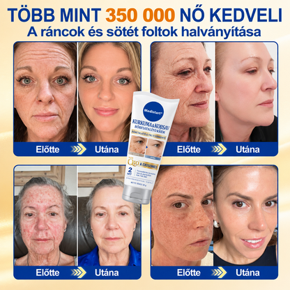 ❄️𝑯𝒊𝒗𝒂𝒕𝒂𝒍𝒐𝒔 𝑼̈𝒛𝒍𝒆𝒕 | 𝐔́𝐣! ✨ Medistart® 𝐊𝐮𝐫𝐤𝐮𝐦𝐚 × 𝐊𝐨𝐣𝐢𝐧𝐬𝐚𝐯 𝐄́𝐣𝐬𝐳𝐚𝐤𝐚𝐢 Bőrfiatalító 𝐊𝐫𝐞́𝐦— 𝐇𝐚𝐥𝐯𝐚́𝐧𝐲𝐢́𝐭𝐬𝐝 𝐚 𝐦𝐚𝐤𝐚𝐜𝐬 𝐬𝐨̈𝐭𝐞́𝐭 𝐟𝐨𝐥𝐭𝐨𝐤𝐚𝐭 𝐞́𝐬 𝐬𝐢𝐦𝐢́𝐭𝐬𝐝 𝐤𝐢 𝐚 𝐥𝐚́𝐭𝐡𝐚𝐭𝐨́ 𝐫𝐚́𝐧𝐜𝐨𝐤𝐚𝐭 𝐚𝐥𝐯𝐚́𝐬 𝐤𝐨̈𝐳𝐛𝐞𝐧 🌙 ✅ 𝐄́𝐣𝐬𝐳𝐚𝐤𝐚́𝐧𝐤𝐞́𝐧𝐭 𝐞𝐠𝐲 𝐥𝐞́𝐩𝐞́𝐬 · 𝐋𝐚́𝐭𝐡𝐚𝐭𝐨́ 𝐯𝐚́𝐥𝐭𝐨𝐳𝐚́𝐬 𝟕 𝐞́𝐣𝐬𝐳𝐚𝐤𝐚 𝐚𝐥𝐚𝐭𝐭 💯