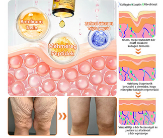 👨‍⚕‍🐝 𝐏𝐮𝐫𝐚𝐂𝐮𝐫𝐞® 𝐌é𝐡𝐦é𝐫𝐞𝐠 𝐁ő𝐫 𝐇𝐞𝐥𝐲𝐫𝐞á𝐥𝐥í𝐭ó 𝐊𝐫é𝐦 (𝐂𝐄 𝐓𝐚𝐧ú𝐬í𝐭𝐯á𝐧𝐲)👍✅