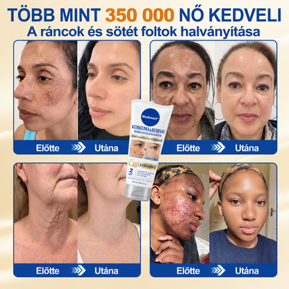 ❄️𝑯𝒊𝒗𝒂𝒕𝒂𝒍𝒐𝒔 𝑼̈𝒛𝒍𝒆𝒕 | 𝐔́𝐣! ✨ Medistart® 𝐊𝐮𝐫𝐤𝐮𝐦𝐚 × 𝐊𝐨𝐣𝐢𝐧𝐬𝐚𝐯 𝐄́𝐣𝐬𝐳𝐚𝐤𝐚𝐢 Bőrfiatalító 𝐊𝐫𝐞́𝐦— 𝐇𝐚𝐥𝐯𝐚́𝐧𝐲𝐢́𝐭𝐬𝐝 𝐚 𝐦𝐚𝐤𝐚𝐜𝐬 𝐬𝐨̈𝐭𝐞́𝐭 𝐟𝐨𝐥𝐭𝐨𝐤𝐚𝐭 𝐞́𝐬 𝐬𝐢𝐦𝐢́𝐭𝐬𝐝 𝐤𝐢 𝐚 𝐥𝐚́𝐭𝐡𝐚𝐭𝐨́ 𝐫𝐚́𝐧𝐜𝐨𝐤𝐚𝐭 𝐚𝐥𝐯𝐚́𝐬 𝐤𝐨̈𝐳𝐛𝐞𝐧 🌙 ✅ 𝐄́𝐣𝐬𝐳𝐚𝐤𝐚́𝐧𝐤𝐞́𝐧𝐭 𝐞𝐠𝐲 𝐥𝐞́𝐩𝐞́𝐬 · 𝐋𝐚́𝐭𝐡𝐚𝐭𝐨́ 𝐯𝐚́𝐥𝐭𝐨𝐳𝐚́𝐬 𝟕 𝐞́𝐣𝐬𝐳𝐚𝐤𝐚 𝐚𝐥𝐚𝐭𝐭 💯