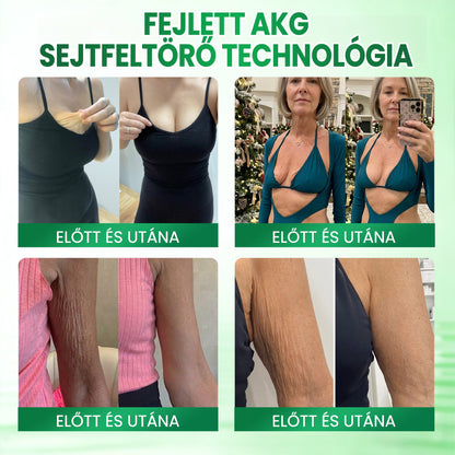 🌸Medistart® AKG BŐRFESZESÍTŐ & ÖREGEDÉS ELLENI ÁPOLÁS