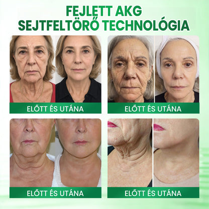 🌸Medistart® AKG BŐRFESZESÍTŐ & ÖREGEDÉS ELLENI ÁPOLÁS