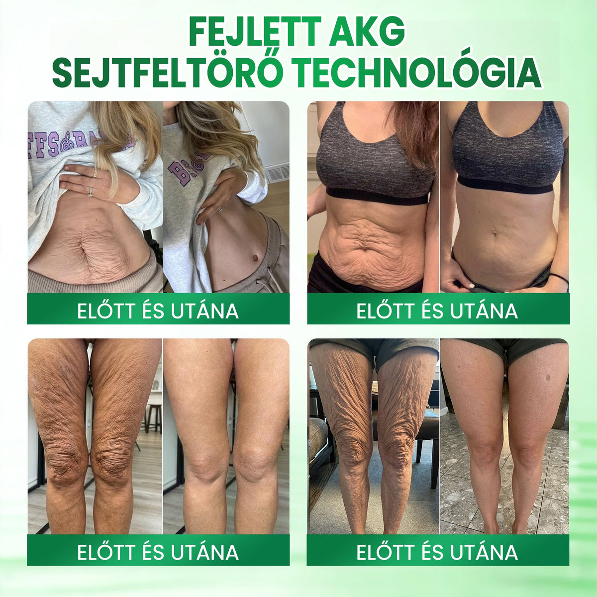 🌸Medistart® AKG BŐRFESZESÍTŐ & ÖREGEDÉS ELLENI ÁPOLÁS