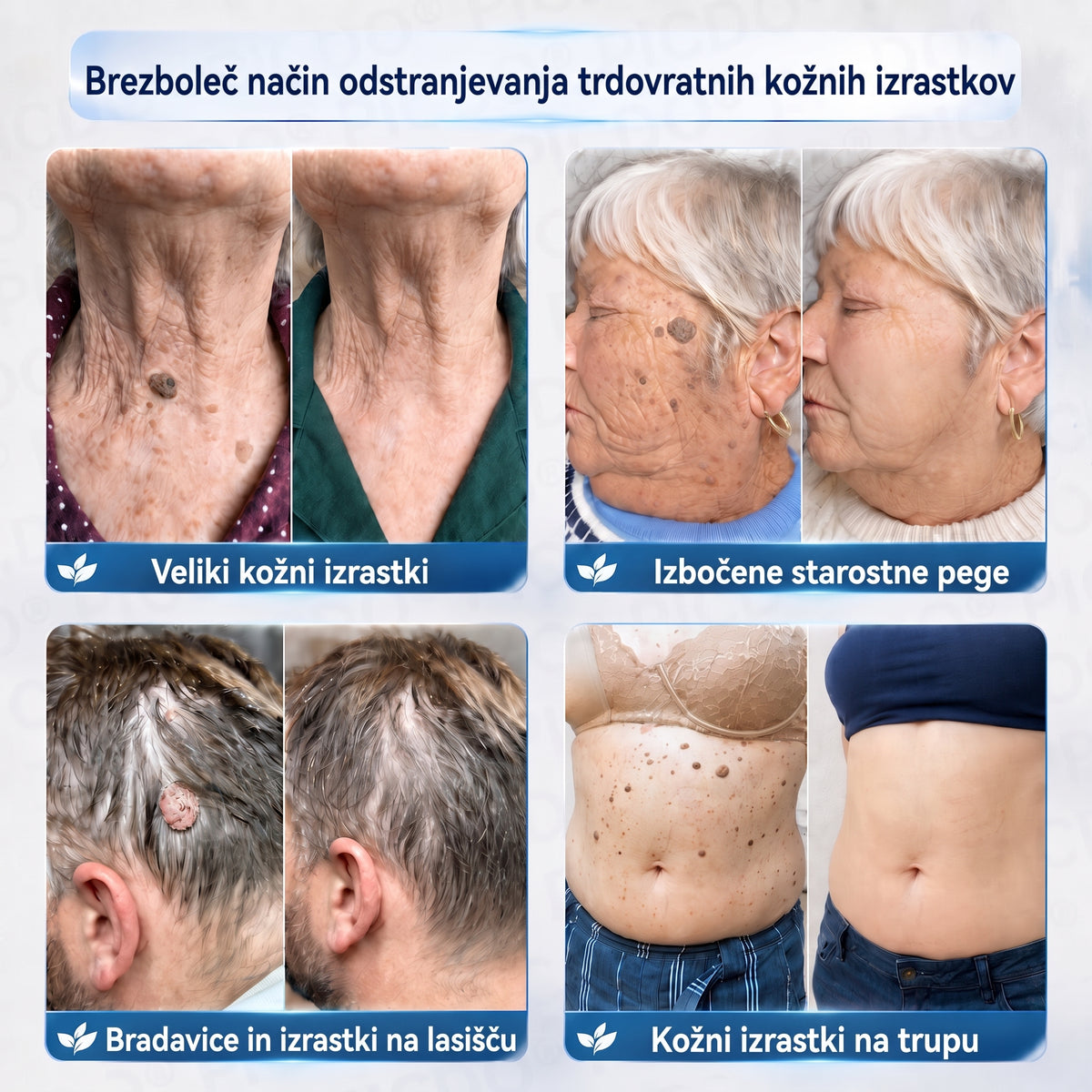 PuraCure® 𝟕 𝐃𝐢𝐞𝐧ų 𝐊𝐫ė𝐦𝐚𝐬 𝐧𝐮𝐨 𝐎𝐝𝐨𝐬 𝐈š𝐨𝐤𝐢ų 𝐢𝐫 𝐏𝐢𝐠𝐦𝐞𝐧𝐭𝐢𝐧𝐢ų 𝐃ė𝐦𝐢ų (𝐍𝐞𝐬𝐤𝐚𝐮𝐬𝐦𝐢𝐧𝐠𝐚 𝐅𝐨𝐫𝐦𝐮𝐥ė – 𝐁𝐞 𝐑𝐚𝐧𝐝ų)🍁
