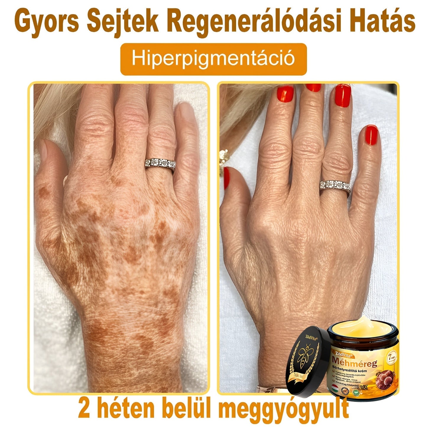 🍃 Bőrgyógyász ajánlása ✨ ZödVita® Méhméreg Bőr Helyreállító Krém 🔥 Magyar fejlesztés, magyarországi gyártás és szállítás