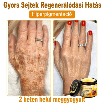 🍃 Bőrgyógyász ajánlása ✨ ZödVita® Méhméreg Bőr Helyreállító Krém 🔥 Magyar fejlesztés, magyarországi gyártás és szállítás