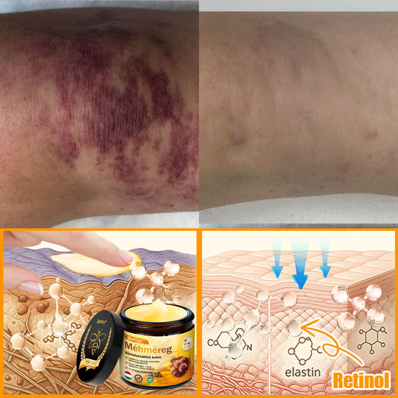 🍎Bőrgyógyász ajánlása ✨ ZödVita® Méhméreg Bőr Helyreállító Krém 🔥 Magyar fejlesztés, magyarországi gyártás és szállítás