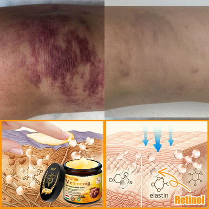 🍎Bőrgyógyász ajánlása ✨ ZödVita® Méhméreg Bőr Helyreállító Krém 🔥 Magyar fejlesztés, magyarországi gyártás és szállítás