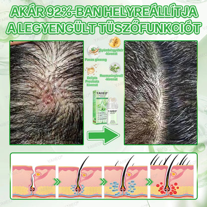 🍌𝐘𝐀𝐈𝐈𝐄𝐎® 𝑭á𝒋𝒅𝒂𝒍𝒐𝒎𝒎𝒆𝒏𝒕𝒆𝒔 𝑴𝒊𝒌𝒓𝒐𝒊𝒏𝒇ú𝒛𝒊ó𝒔 𝑹𝒆𝒏𝒅𝒔𝒛𝒆𝒓 Mélyen ható DHT-blokkolás, hajhagymák újraaktiválása és látható hajnövekedés