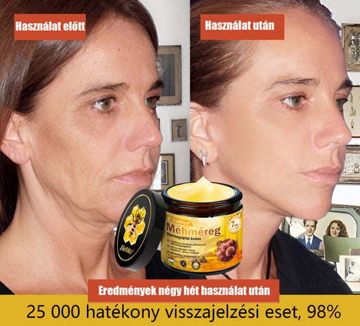 🍃 Bőrgyógyász ajánlása ✨ ZödVita® Méhméreg Bőr Helyreállító Krém 🔥 Magyar fejlesztés, magyarországi gyártás és szállítás