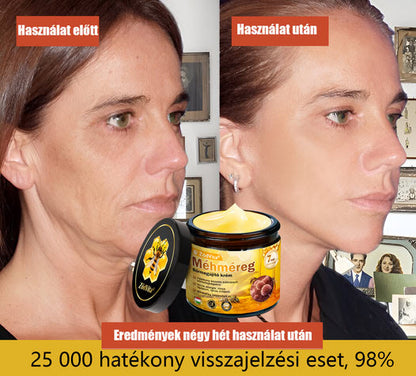 🍃 Bőrgyógyász ajánlása ✨ ZödVita® Méhméreg Bőr Helyreállító Krém 🔥 Magyar fejlesztés, magyarországi gyártás és szállítás