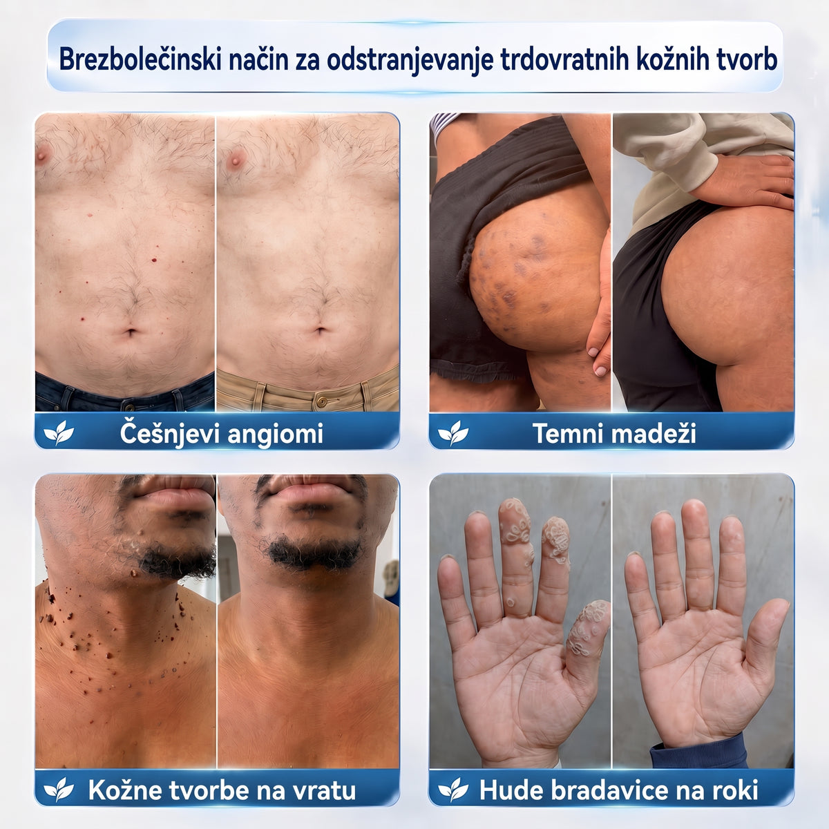 PuraCure® 𝟕 𝐃𝐢𝐞𝐧ų 𝐊𝐫ė𝐦𝐚𝐬 𝐧𝐮𝐨 𝐎𝐝𝐨𝐬 𝐈š𝐨𝐤𝐢ų 𝐢𝐫 𝐏𝐢𝐠𝐦𝐞𝐧𝐭𝐢𝐧𝐢ų 𝐃ė𝐦𝐢ų (𝐍𝐞𝐬𝐤𝐚𝐮𝐬𝐦𝐢𝐧𝐠𝐚 𝐅𝐨𝐫𝐦𝐮𝐥ė – 𝐁𝐞 𝐑𝐚𝐧𝐝ų)🍁