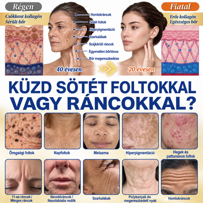 ❄️𝑯𝒊𝒗𝒂𝒕𝒂𝒍𝒐𝒔 𝑼̈𝒛𝒍𝒆𝒕 | 𝐔́𝐣! ✨ Medistart® 𝐊𝐮𝐫𝐤𝐮𝐦𝐚 × 𝐊𝐨𝐣𝐢𝐧𝐬𝐚𝐯 𝐄́𝐣𝐬𝐳𝐚𝐤𝐚𝐢 Bőrfiatalító 𝐊𝐫𝐞́𝐦— 𝐇𝐚𝐥𝐯𝐚́𝐧𝐲𝐢́𝐭𝐬𝐝 𝐚 𝐦𝐚𝐤𝐚𝐜𝐬 𝐬𝐨̈𝐭𝐞́𝐭 𝐟𝐨𝐥𝐭𝐨𝐤𝐚𝐭 𝐞́𝐬 𝐬𝐢𝐦𝐢́𝐭𝐬𝐝 𝐤𝐢 𝐚 𝐥𝐚́𝐭𝐡𝐚𝐭𝐨́ 𝐫𝐚́𝐧𝐜𝐨𝐤𝐚𝐭 𝐚𝐥𝐯𝐚́𝐬 𝐤𝐨̈𝐳𝐛𝐞𝐧 🌙 ✅ 𝐄́𝐣𝐬𝐳𝐚𝐤𝐚́𝐧𝐤𝐞́𝐧𝐭 𝐞𝐠𝐲 𝐥𝐞́𝐩𝐞́𝐬 · 𝐋𝐚́𝐭𝐡𝐚𝐭𝐨́ 𝐯𝐚́𝐥𝐭𝐨𝐳𝐚́𝐬 𝟕 𝐞́𝐣𝐬𝐳𝐚𝐤𝐚 𝐚𝐥𝐚𝐭𝐭 💯