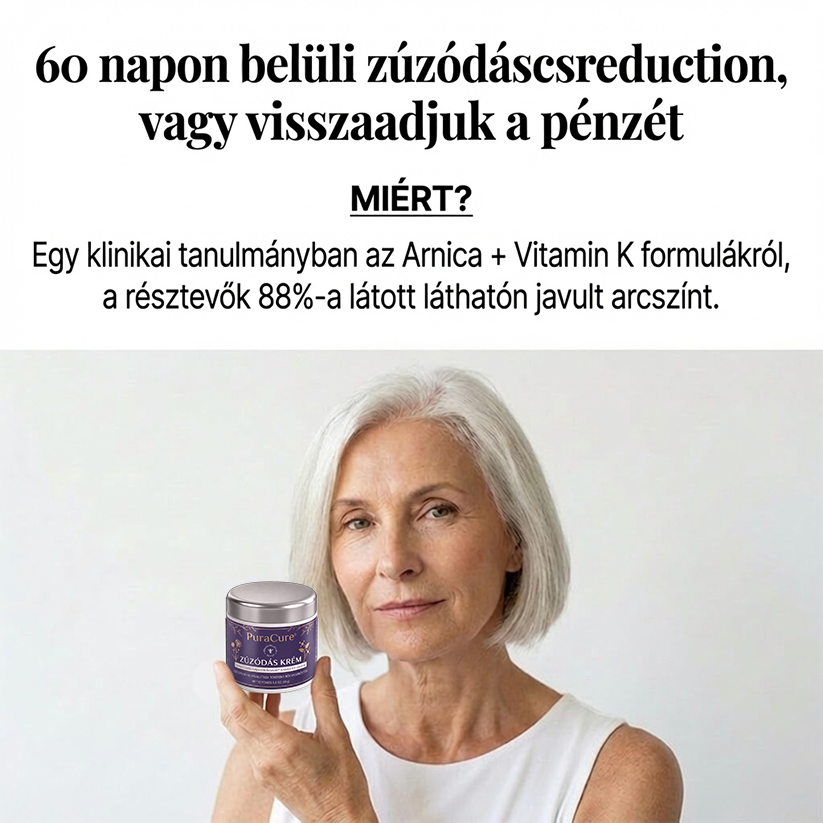 🍃🍃👉100K+ ELADVA 💁‍♀️ – PuraCure® Zúzódásjavító és bőrerősítő krém