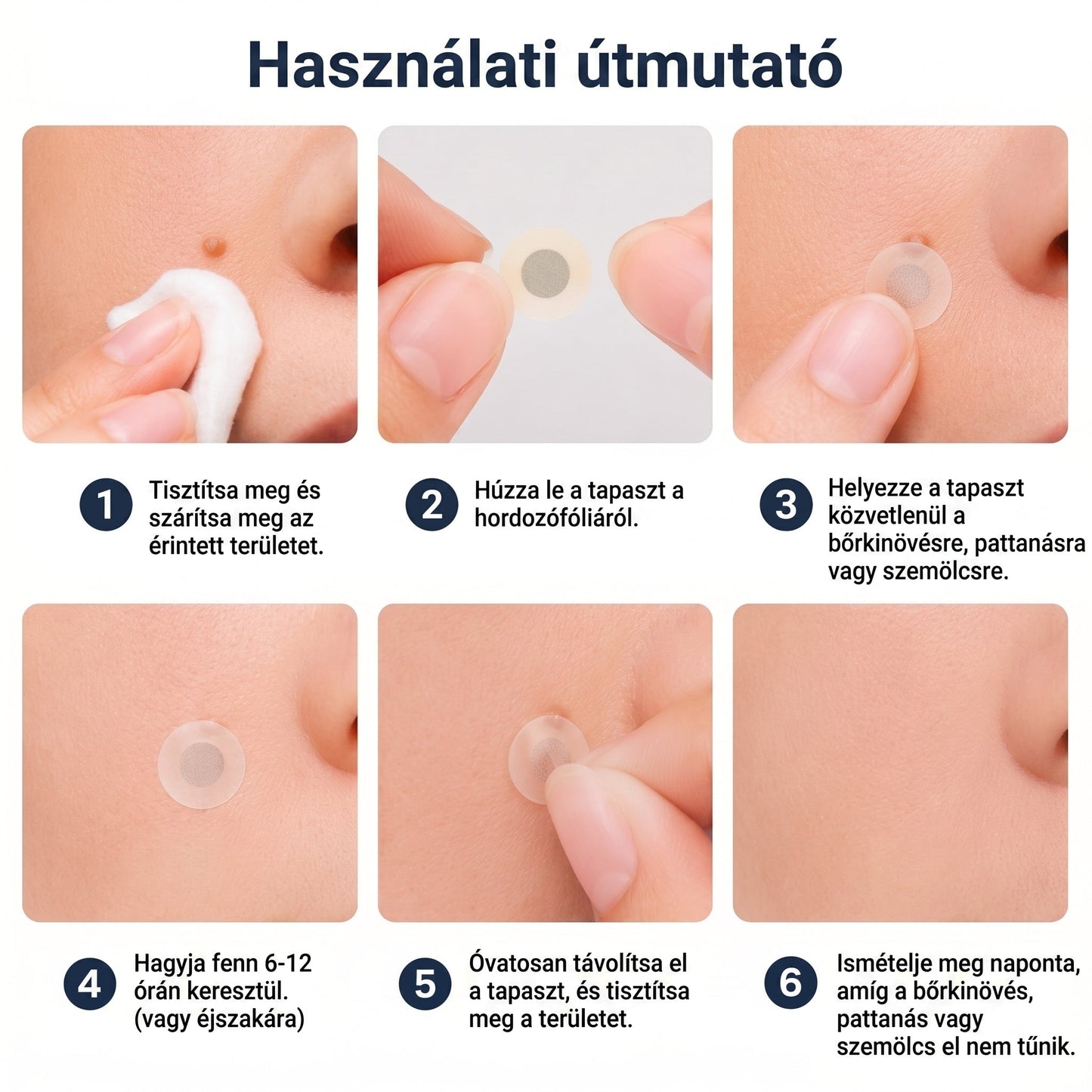 🌿🌿✨ 2 az 1-ben mikrotűs és hidrokolloid tapasz🍀 | Kiálló anyajegyek, aknék, lapos szemölcsök és bőrnövedékek eltávolítására | Segít csökkenteni a ráncokat, hegeket és bőrhibákat | Láthatatlan tapasz az arcra és testre