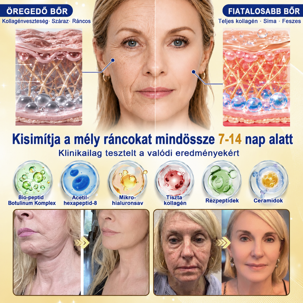 ❄️𝑯𝒊𝒗𝒂𝒕𝒂𝒍𝒐𝒔 𝑼̈𝒛𝒍𝒆𝒕 | 𝐔́𝐣! ✨ Medistart® 𝐊𝐮𝐫𝐤𝐮𝐦𝐚 × 𝐊𝐨𝐣𝐢𝐧𝐬𝐚𝐯 𝐄́𝐣𝐬𝐳𝐚𝐤𝐚𝐢 Bőrfiatalító 𝐊𝐫𝐞́𝐦— 𝐇𝐚𝐥𝐯𝐚́𝐧𝐲𝐢́𝐭𝐬𝐝 𝐚 𝐦𝐚𝐤𝐚𝐜𝐬 𝐬𝐨̈𝐭𝐞́𝐭 𝐟𝐨𝐥𝐭𝐨𝐤𝐚𝐭 𝐞́𝐬 𝐬𝐢𝐦𝐢́𝐭𝐬𝐝 𝐤𝐢 𝐚 𝐥𝐚́𝐭𝐡𝐚𝐭𝐨́ 𝐫𝐚́𝐧𝐜𝐨𝐤𝐚𝐭 𝐚𝐥𝐯𝐚́𝐬 𝐤𝐨̈𝐳𝐛𝐞𝐧 🌙 ✅ 𝐄́𝐣𝐬𝐳𝐚𝐤𝐚́𝐧𝐤𝐞́𝐧𝐭 𝐞𝐠𝐲 𝐥𝐞́𝐩𝐞́𝐬 · 𝐋𝐚́𝐭𝐡𝐚𝐭𝐨́ 𝐯𝐚́𝐥𝐭𝐨𝐳𝐚́𝐬 𝟕 𝐞́𝐣𝐬𝐳𝐚𝐤𝐚 𝐚𝐥𝐚𝐭𝐭 💯