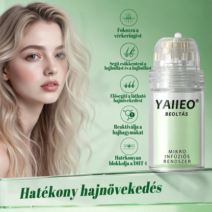 🍌𝐘𝐀𝐈𝐈𝐄𝐎® 𝑭á𝒋𝒅𝒂𝒍𝒐𝒎𝒎𝒆𝒏𝒕𝒆𝒔 𝑴𝒊𝒌𝒓𝒐𝒊𝒏𝒇ú𝒛𝒊ó𝒔 𝑹𝒆𝒏𝒅𝒔𝒛𝒆𝒓 Mélyen ható DHT-blokkolás, hajhagymák újraaktiválása és látható hajnövekedés