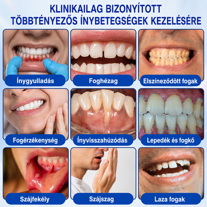 🌿🌿🦷 PuraCure® ÍNYMEGÚJÍTÓ – Parodontális helyreállító gél🧂