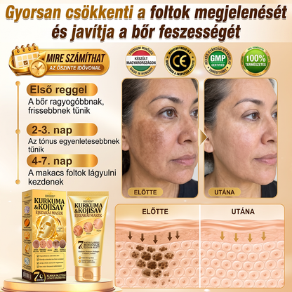 🍇🍇𝑯𝒊𝒗𝒂𝒕𝒂𝒍𝒐𝒔 𝑼̈𝒛𝒍𝒆𝒕 | 𝐔́𝐣! ✨ 𝐇𝐢𝐬𝐤𝐢𝐧® 𝐊𝐮𝐫𝐤𝐮𝐦𝐚 × 𝐊𝐨𝐣𝐢𝐧𝐬𝐚𝐯 𝐄́𝐣𝐬𝐳𝐚𝐤𝐚𝐢 𝐋𝐞𝐡𝐮́𝐳𝐡𝐚𝐭𝐨́ 𝐌𝐚𝐬𝐳𝐤 — 𝐇𝐚𝐥𝐯𝐚́𝐧𝐲𝐢́𝐭𝐬𝐝 𝐚 𝐦𝐚𝐤𝐚𝐜𝐬 𝐬𝐨̈𝐭𝐞́𝐭 𝐟𝐨𝐥𝐭𝐨𝐤𝐚𝐭 𝐞́𝐬 𝐬𝐢𝐦𝐢́𝐭𝐬𝐝 𝐤𝐢 𝐚 𝐥𝐚́𝐭𝐡𝐚𝐭𝐨́ 𝐫𝐚́𝐧𝐜𝐨𝐤𝐚𝐭 𝐚𝐥𝐯𝐚́𝐬 𝐤𝐨̈𝐳𝐛𝐞𝐧 🌙 ✅ 𝐄́𝐣𝐬𝐳𝐚𝐤𝐚́𝐧𝐤𝐞́𝐧𝐭 𝐞𝐠𝐲 𝐥𝐞́𝐩𝐞́𝐬 · 𝐋𝐚́𝐭𝐡𝐚𝐭𝐨́ 𝐯𝐚́𝐥𝐭𝐨𝐳𝐚́𝐬 𝟕 𝐞́𝐣𝐬𝐳𝐚𝐤𝐚 𝐚𝐥𝐚𝐭𝐭 💯